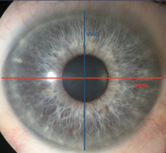 Presbyopia Treatments by Mechanism of Action: A New Classification System Based on a Review of the Literature