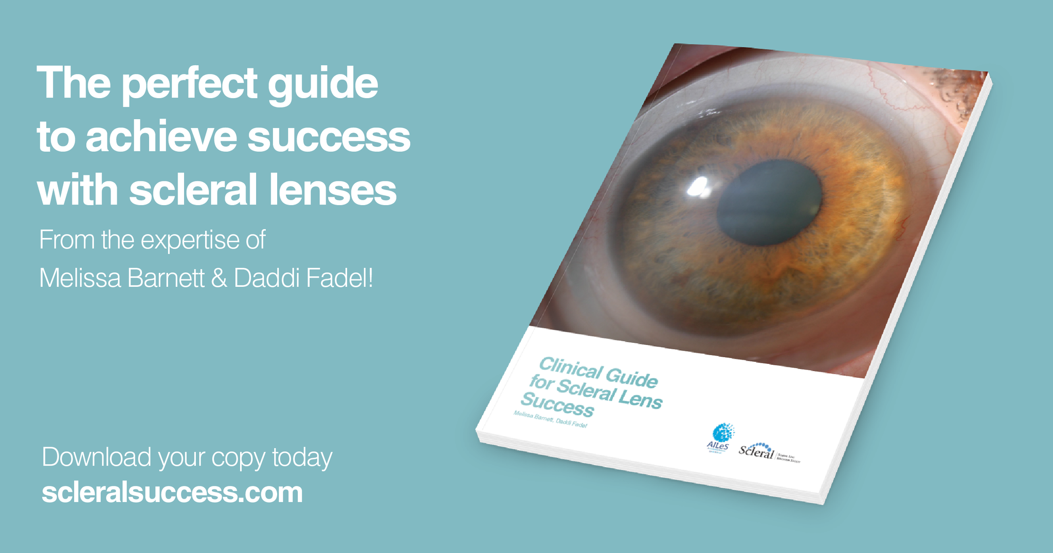 Scleral Lens Success clinical guide