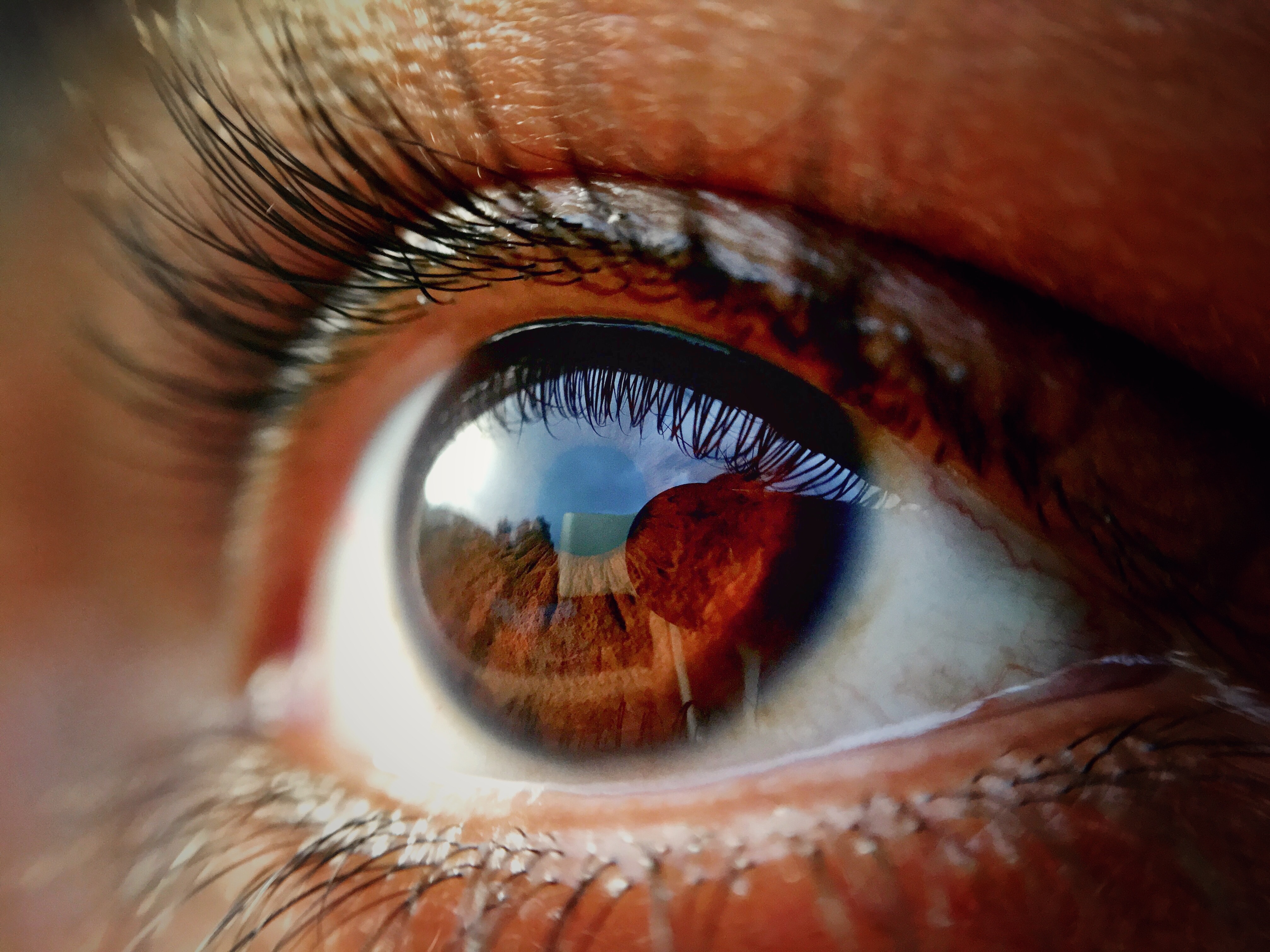 Clinical Outcomes of Scleral Lens Fitting with a Data-driven, Quadrant-specific Design: Multicenter Review